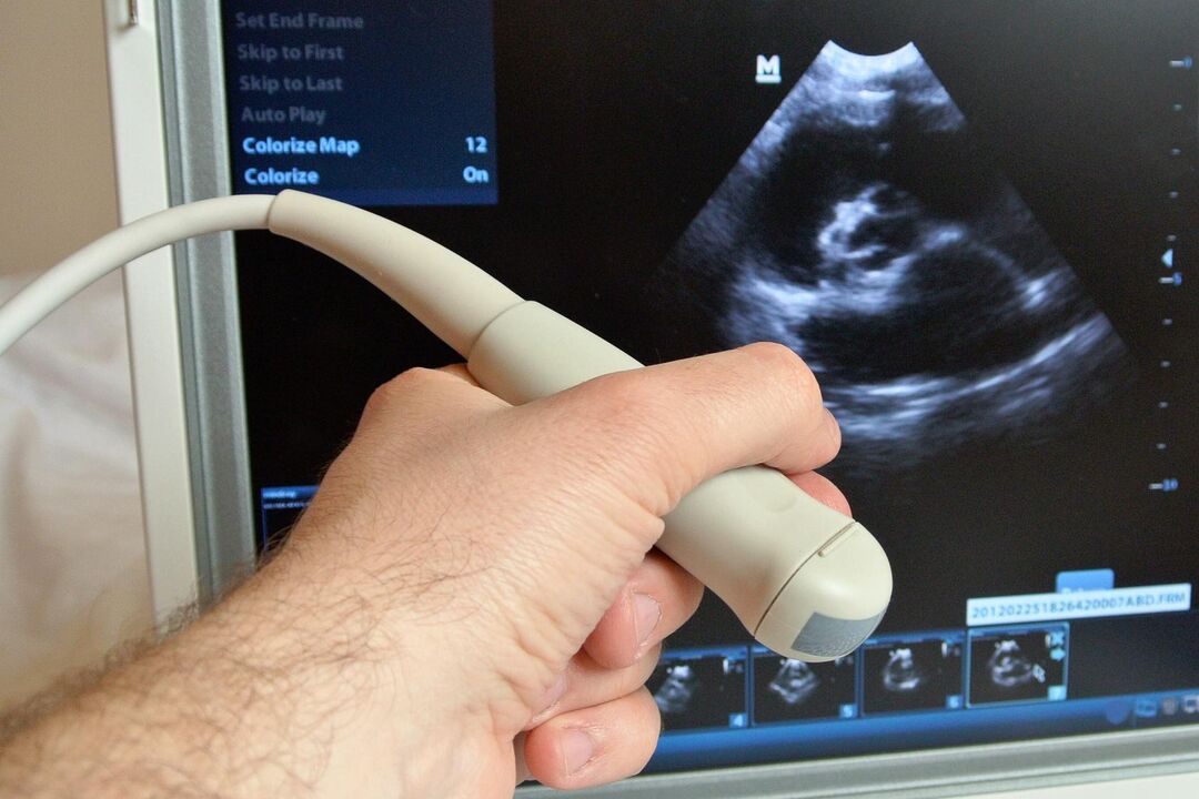 Ultrasound will help diagnose congestive prostatitis in a man